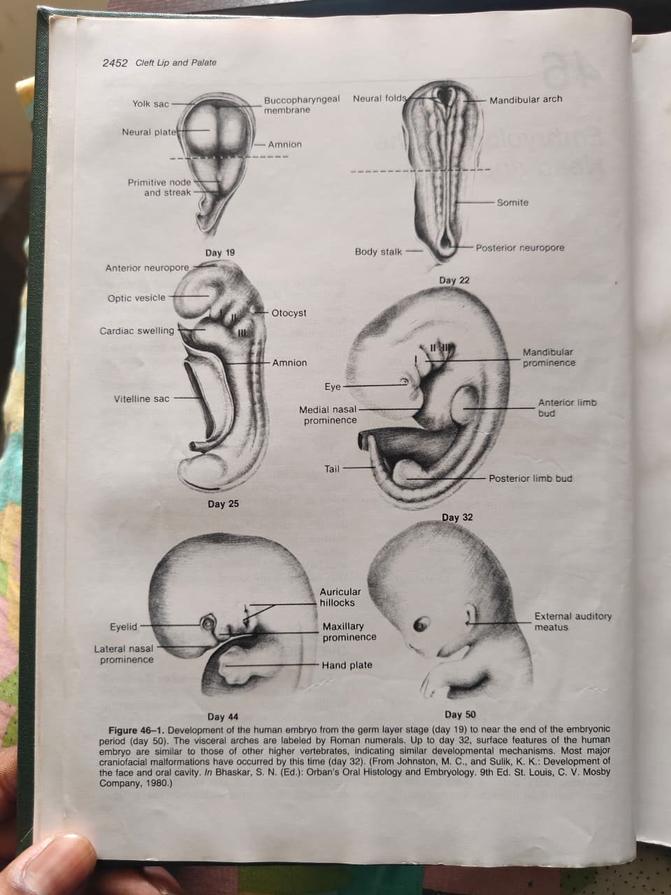 Figure 46-1 - Human Embryo Development Day 19-50
